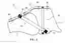 Fig. 05 - Bone securement apparatus and method