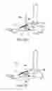 Fig. 10 - Bone securement apparatus and method