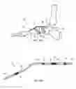 Fig. 11 - Bone securement apparatus and method