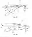 Fig. 13 - Bone securement apparatus and method