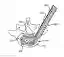 Fig. 01 - INTERVERTEBRAL IMPLANT