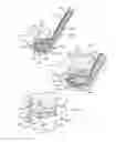 Fig. 03 - INTERVERTEBRAL IMPLANT