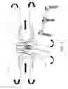 Fig. 02 - Additive manufacturing for spinal implants