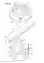 Fig. 06 - Spinal implant locking member with improved guidance, tactile and visual feedback