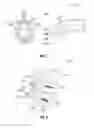 Fig. 02 - VERTEBRAL FIXATION DEVICES, SYSTEMS, AND METHODS