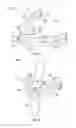 Fig. 03 - VERTEBRAL FIXATION DEVICES, SYSTEMS, AND METHODS