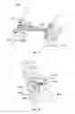 Fig. 09 - VERTEBRAL FIXATION DEVICES, SYSTEMS, AND METHODS