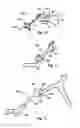 Fig. 07 - Laminoplasty fixation devices