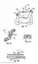 Fig. 09 - Laminoplasty fixation devices