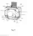 Fig. 06 - Facet joint replacement instruments and methods