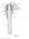 Fig. 22 - Facet joint replacement instruments and methods