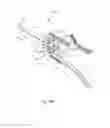 Fig. 43 - Facet joint replacement instruments and methods