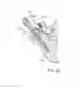 Fig. 53 - Facet joint replacement instruments and methods