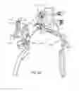 Fig. 65 - Facet joint replacement instruments and methods