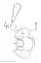 Fig. 35 - Shape adaptable intramedullary fixation device