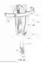 Fig. 30 - Method and apparatus for treating a bone fracture