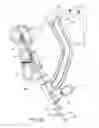 Fig. 40 - Method and apparatus for treating a bone fracture