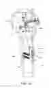 Fig. 43 - Method and apparatus for treating a bone fracture