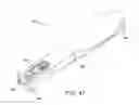 Fig. 46 - Method and apparatus for treating a bone fracture