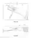 Fig. 50 - Method and apparatus for treating a bone fracture