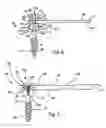 Fig. 03 - Bone plates, screws and instruments