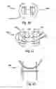 Fig. 08 - Bone plates, screws and instruments