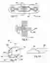 Fig. 13 - Bone plates, screws and instruments