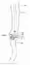 Fig. 01 - Method and apparatus for gastrointestinal tract ablation to achieve loss of persistent and/or recurrent excess body weight following a weight loss operation