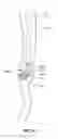 Fig. 04 - Method and apparatus for gastrointestinal tract ablation to achieve loss of persistent and/or recurrent excess body weight following a weight loss operation