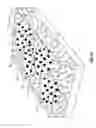 Fig. 37 - Method and apparatus for gastrointestinal tract ablation to achieve loss of persistent and/or recurrent excess body weight following a weight loss operation