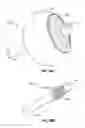 Fig. 40 - Method and apparatus for gastrointestinal tract ablation to achieve loss of persistent and/or recurrent excess body weight following a weight loss operation