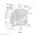 Fig. 12 - High-density electrode-based medical device system