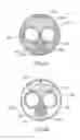 Fig. 06 - Electrosurgical tissue treatment device