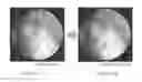 Fig. 06 - SURGICAL DEVICES AND METHODS OF USE THEREOF