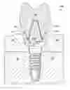 Fig. 01 - Methods and devices for countering gingival effects in dental restoration