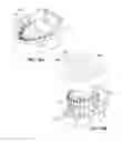 Fig. 40 - Impressionless dental modeling systems and methods