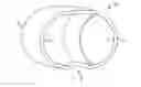 Fig. 01 - Cuff of an artificial urinary sphincter system