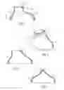 Fig. 04 - Method of treating urinary incontinence