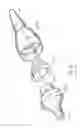 Fig. 12 - Method of treating urinary incontinence