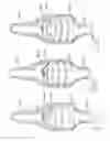 Fig. 15 - Method of treating urinary incontinence