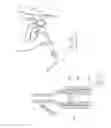 Fig. 22 - Method of treating urinary incontinence