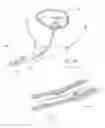 Fig. 24 - Method of treating urinary incontinence