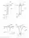 Fig. 33 - Method of treating urinary incontinence