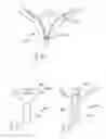 Fig. 34 - Method of treating urinary incontinence