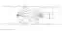 Fig. 01 - Embolus blood clot filter delivery system