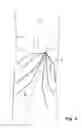 Fig. 05 - Embolus blood clot filter delivery system