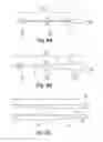 Fig. 10 - Embolus blood clot filter delivery system