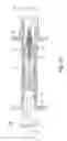 Fig. 14 - Embolus blood clot filter delivery system