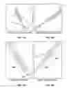 Fig. 09 - DEVICE AND METHOD FOR PREVENTING STENOSIS AT AN ANASTOMOSIS SITE