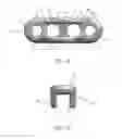 Fig. 05 - Tissue graft fixation